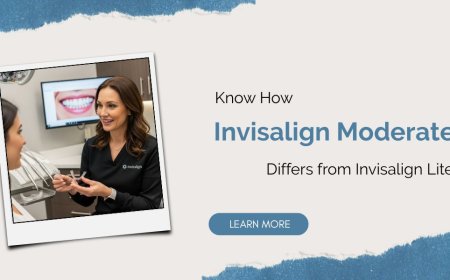 Know How Invisalign Moderate Differs from Invisalign Lite