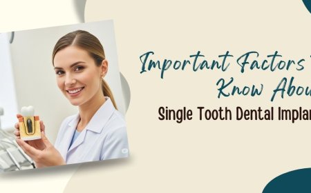 Important Factors to Know About Single Tooth Dental Implants
