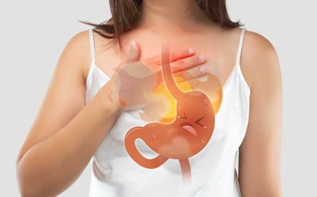 Gastroesophageal Reflux Disease (GERD): When Acid Becomes a Problem