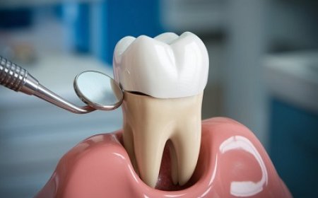 Seamless Dental Crowns That Match Tooth Shade